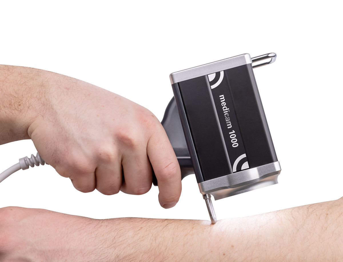 Fotofinder scannt Hautbereich